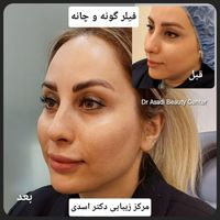 مرکز زیبایی دکتر اسدی (بوتاکس لیزر هایفو فیلر)|خدمات آرایشگری و زیبایی|تهران, نیاوران|دیوار