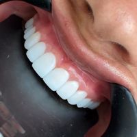 دندانپزشکی.ارتودنسی.عصب کشی.کامپوزیت|خدمات آرایشگری و زیبایی|تهران, مجیدیه|دیوار
