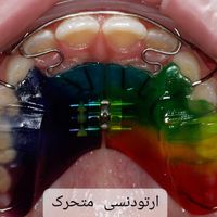 ارتودنسی تخصصی ثابت و متحرک|خدمات آرایشگری و زیبایی|تهران, قبا|دیوار