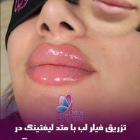 کلینیک تخصصی آوینا|خدمات آرایشگری و زیبایی|تهران, گاندی|دیوار