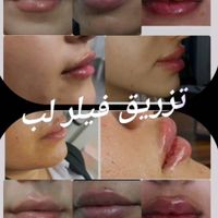 مطب زیبایی ولیزر دکتر محمود مجملی|خدمات آرایشگری و زیبایی|اصفهان, باغ زرشک|دیوار