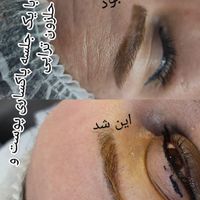 سم زدایی بدن . پاکسازی پوست فشیال درمان پوست|خدمات آرایشگری و زیبایی|کرج, شاهین‌ویلا|دیوار