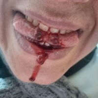 طب سنتی طب سوزنی حجامت فصد زالو تل گیری س زدایی|خدمات آرایشگری و زیبایی|کرج, حصارک|دیوار