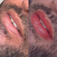 رفع تیرگی لب آقایان سیاهی لب|خدمات آرایشگری و زیبایی|تهران, دریاچه شهدای خلیج فارس|دیوار