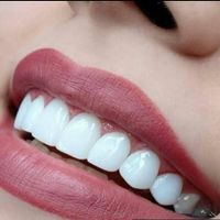 مدل کامپوزیت ونیر به مدت یک هفته|خدمات آرایشگری و زیبایی|تهران, جنت‌آباد جنوبی|دیوار