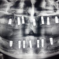 دندانپزشکی تخصصی مهراب(قطب منتخب ایمپلنت،زیبایی)|خدمات آرایشگری و زیبایی|تهران, فلاح|دیوار