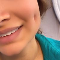 آموزش فوق تخصصی پرسینگ میکرو چال لپ|خدمات آموزشی|تهران, بهاران|دیوار