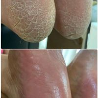 آموزش و خدمات تخصصی پدیکور و کفسابی پا و ژلیش پا|خدمات آرایشگری و زیبایی|اصفهان, احمدآباد|دیوار