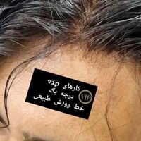 پروتز مو بلک|خدمات آرایشگری و زیبایی|تهران, نازی‌آباد|دیوار