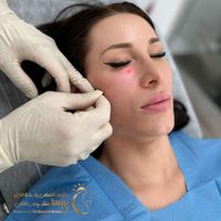 معجزه ای به نام اندولیفت|خدمات آرایشگری و زیبایی|تهران, گاندی|دیوار