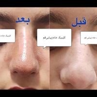 کلینیک خانه زیبایی قم|خدمات آرایشگری و زیبایی|قم, باجک (۱۹ دی)|دیوار