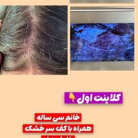 اسکراپ اسکالپ تخصصی (درمان ریزش مو)|خدمات آرایشگری و زیبایی|قم, زنبیل‌آباد (شهید صدوقی)|دیوار