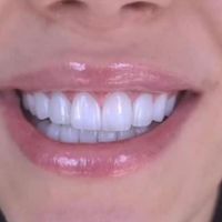 دندانپزشکی.ارتودنسی.عصب کشی.کامپوزیت|خدمات آرایشگری و زیبایی|تهران, مجیدیه|دیوار