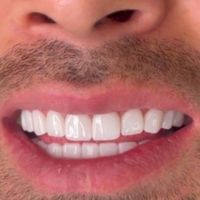 دندانپزشکی.ارتودنسی.عصب کشی.کامپوزیت|خدمات آرایشگری و زیبایی|تهران, مجیدیه|دیوار