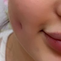 آموزش فوق تخصصی پرسینگ میکرو چال لپ|خدمات آموزشی|تهران, بهاران|دیوار