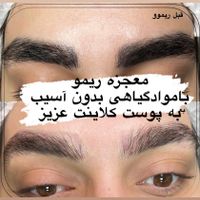 میکروطبیعی ومویی،ریمو گیاهی(سالاریه)|خدمات آرایشگری و زیبایی|قم, سالاریه|دیوار