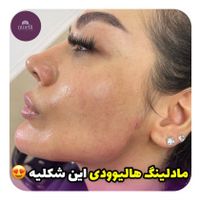 ژل و بوتاکس درافسریه|خدمات آرایشگری و زیبایی|تهران, افسریه|دیوار