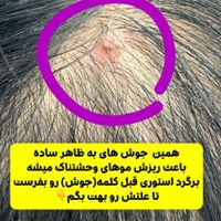 اسکراپ اسکالپ تخصصی (درمان ریزش مو)|خدمات آرایشگری و زیبایی|قم, زنبیل‌آباد (شهید صدوقی)|دیوار