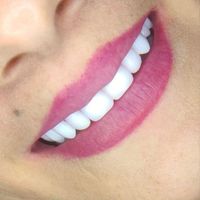 دندان مصنوعی لمینتی .اقساط|خدمات آرایشگری و زیبایی|تهران, نواب|دیوار