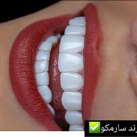 تخفیفات نوروزی کامپوزیت دندان آفر ویژه|خدمات آرایشگری و زیبایی|تهران, تهران‌سر|دیوار