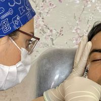 تزریق ژل و بوتاکس توسط دکتر حقانی|خدمات آرایشگری و زیبایی|اصفهان, بهارستان|دیوار