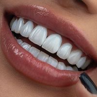 دندانسازی/ دست دندان مصنوعی/متحرک|خدمات آرایشگری و زیبایی|تهران, سلسبیل|دیوار