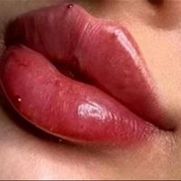 اموزش فیلر و بوتاکس و..|خدمات آموزشی|تهران, جمهوری|دیوار