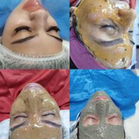 سم زدایی بدن . پاکسازی پوست فشیال درمان پوست|خدمات آرایشگری و زیبایی|کرج, شاهین‌ویلا|دیوار