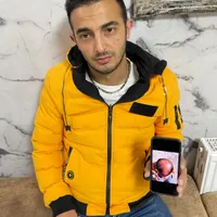 کاشت مو تبریز