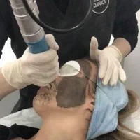 رفع تیرگی بالیزر کیوسوئیچ صورت بیکینی و ریموتاتو