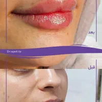 لب / ژل لب / روسی و طبیعی