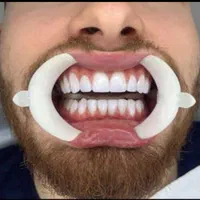 اقساط بلند مدت کامپوزیت لمینیت خدمات درمانی دندان