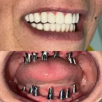 کلینیک تخصصی، دیجیتالی ایمپلنت و کاشت دندان حـامـی|خدمات آرایشگری و زیبایی|شیراز, ملاصدرا|دیوار