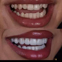 دندان پزشکی  اقساطی  شعبه کمالشهر،فردیس،