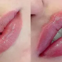 لیزر مو‌- ژل - زیبایی چهره و بدن توسط پزشکان مجرب|خدمات آرایشگری و زیبایی|اردبیل, |دیوار