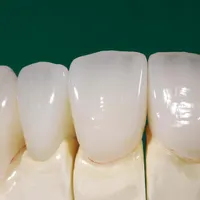جرمگیری .سفید کردن دندان.روکش|خدمات آرایشگری و زیبایی|تهران, میرداماد|دیوار