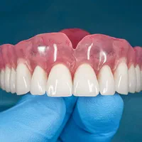 دندانسازی20سال سابقه.دندان مصنوعی(100%ضمانتی)