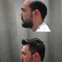 پروتزموترمیم مو پرپشتی مو در1جلسه|خدمات آرایشگری و زیبایی|اصفهان, نقش جهان|دیوار