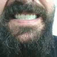 کیلینیک دندان مصنوعی (اقساط با چک صیادی)|خدمات آرایشگری و زیبایی|خرمدره, |دیوار