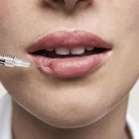 ژل لب مدل روسی و طبیعی بوتاکس میگرن مزوژل|خدمات آرایشگری و زیبایی|تهران, شاهین|دیوار
