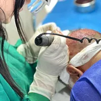 آموزش و استخدام کاشت مو