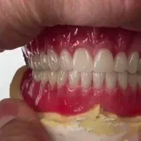 دست دندان طرح لمینیت