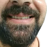 کیلینیک دندان مصنوعی (اقساط با چک صیادی)|خدمات آرایشگری و زیبایی|خرمدره, |دیوار