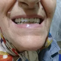 کیلینیک دندان مصنوعی (اقساط با چک صیادی)|خدمات آرایشگری و زیبایی|خرمدره, |دیوار