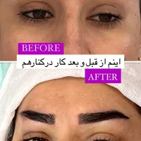 کاشت ابرو پر تراکم با خواب طبیعی|خدمات آرایشگری و زیبایی|تهران, میدان انقلاب|دیوار