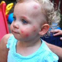 سمپاشی و موریانه زدایی تضمینی امیدیه