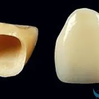 جرمگیری .سفید کردن دندان.روکش|خدمات آرایشگری و زیبایی|تهران, میرداماد|دیوار