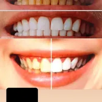 انجام کلیه خدمات دندان مصنوعی|خدمات آرایشگری و زیبایی|تربت‌حیدریه, |دیوار