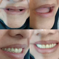 انجام کلیه خدمات دندان مصنوعی|خدمات آرایشگری و زیبایی|تربت‌حیدریه, |دیوار
