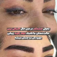 کاشت ابرو پر تراکم با خواب طبیعی|خدمات آرایشگری و زیبایی|تهران, میدان انقلاب|دیوار
